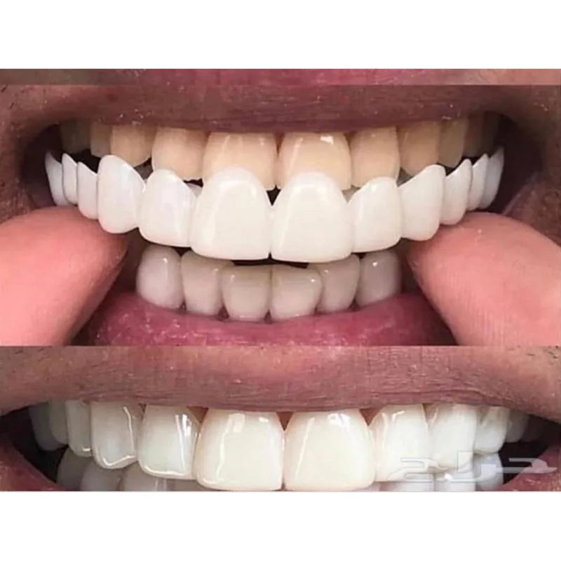 New Snap Smile Customized Label Upper False Teeth Cover Perfect Smile Veneers Comfort Fit Flex Denture Braces Teeth Whitening